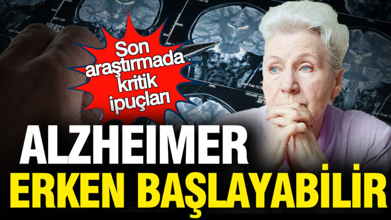 arastirma-alzheimer-dusunuldugunden-daha-erken-baslayabilir-gbWDEyZA